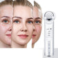 Import Instrument Beauty Instrument Face Export Blackhead Facial Cleansing Instrument